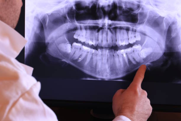 Best Emergency Gum Treatment in South Monroe, MI