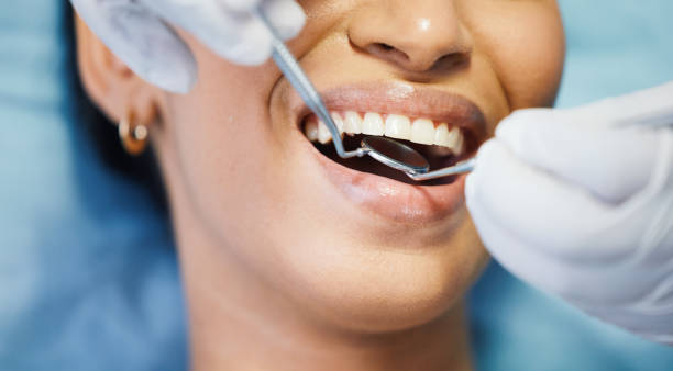 Best Emergency Wisdom Teeth Removal in South Monroe, MI